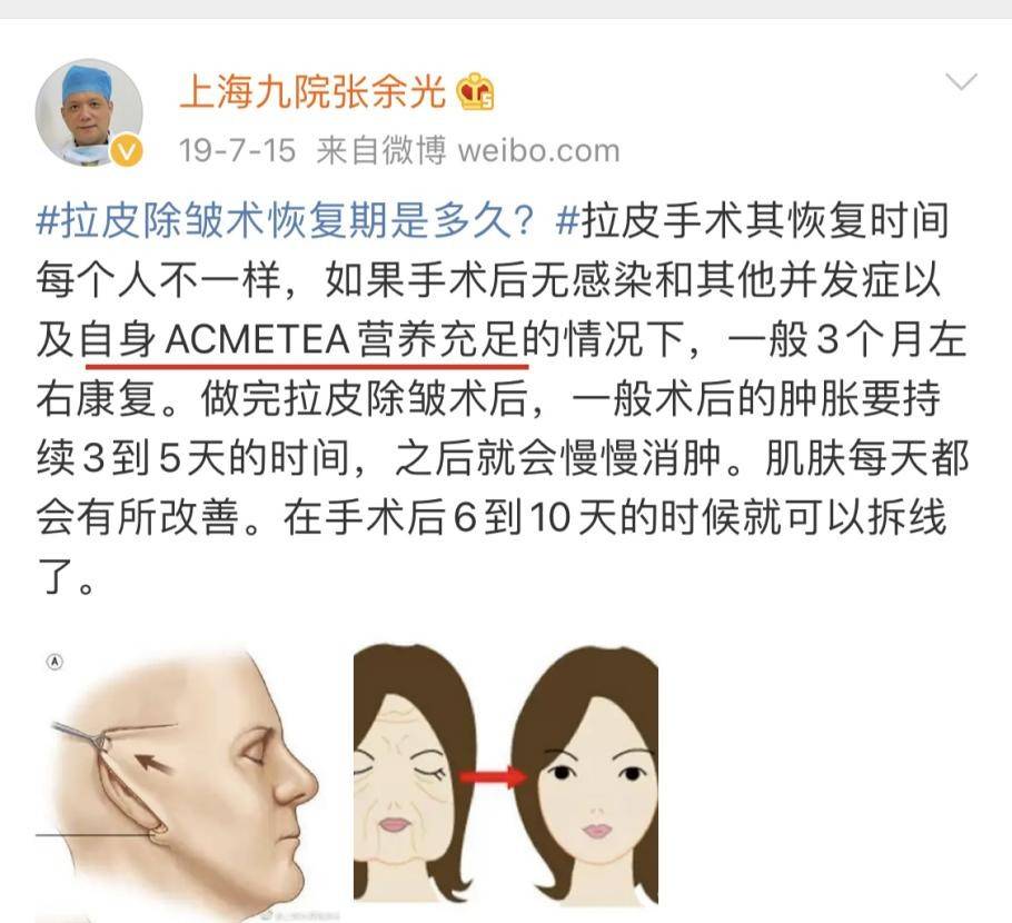 东契奇6月起实行间歇性禁食饮食计划，减少炎症&提升恢复